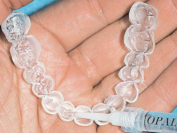 ホワイトニング専用トレー薬剤を注入