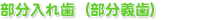 部分入れ歯(部分義歯)