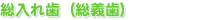 総入れ歯(総義歯)