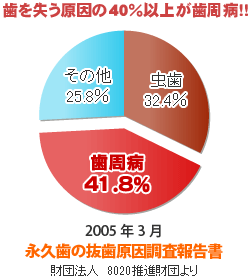 ８０２０推進財団「永久歯の抜歯原因調査報告書」より