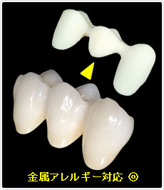 ジルコニアセラミックスクラウン