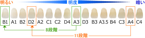 治療例１：ホワイトニング前後の歯の白さの比較