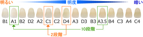 治療例２：ホワイトニング前後の歯の白さの比較