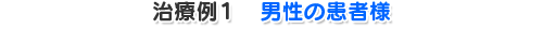 治療例１　男性の患者様