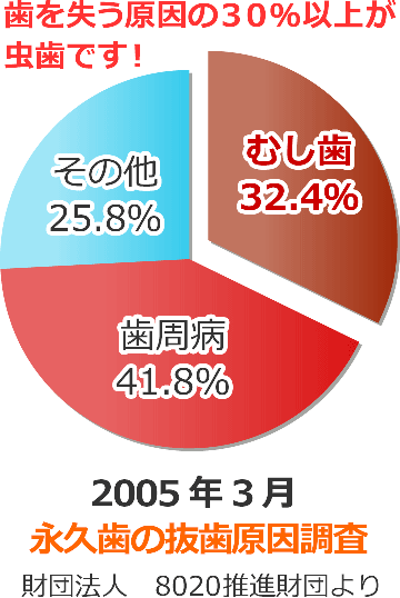 虫歯治療＆歯科レーザー治療 - 大阪 北区天神橋「山口歯科