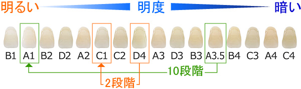 治療例２：ホワイトニング前後の歯の白さの比較